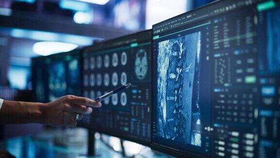 现代医学研究中心:匿名医生指着台式电脑显示器用CT扫描人类脊髓专家寻找肿瘤或损伤寻找治疗方法