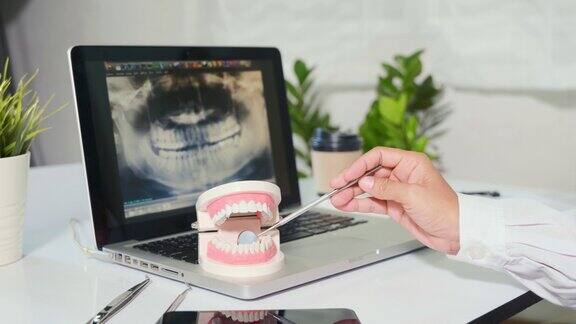 牙医健康白牙模型及探照镜工具在牙医向病人讲解中的应用
