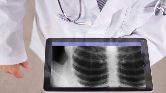 医生在平板电脑上检查乳房x光片