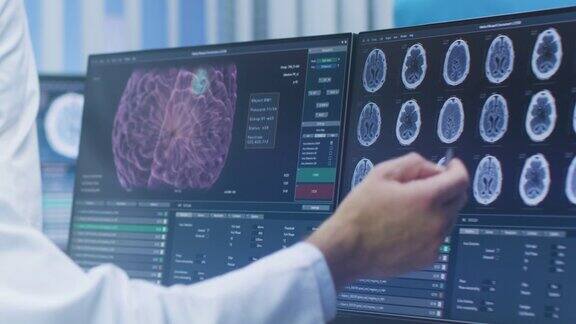 在实验室的个人电脑上展示和指向CTMRI大脑扫描图像的科学家的手的特写医学研究中心的神经学家神经科学家致力于脑肿瘤的治疗