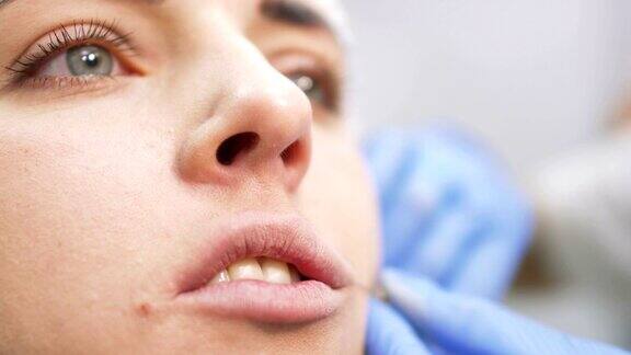 用肉毒杆菌增加嘴唇的美容程序