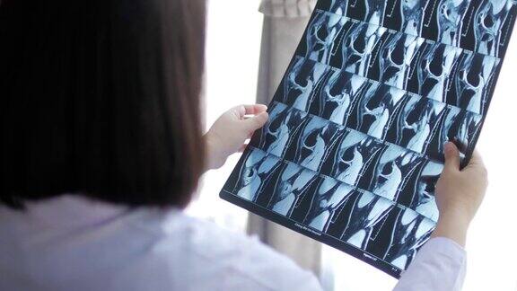 女医生拿着x光片进行磁共振成像(MRI)分析