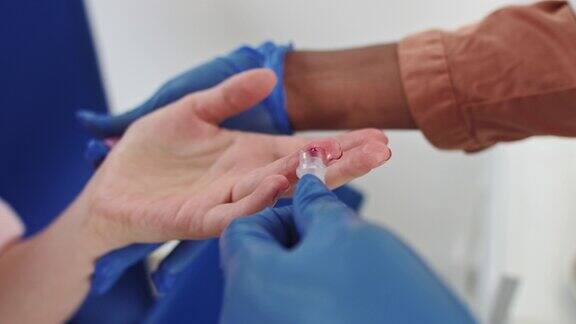 手指血液测试手戴手套采集血样的特写血液检测的特写护士从男性手上抽血医学测试艾滋病毒护士用试管采血
