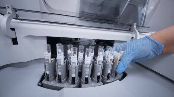 全自动免疫化学分析仪过敏症诊断实验室血液检测
