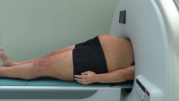 肥胖人被困在核磁共振机器里