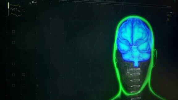 在屏幕上显示病人大脑扫描结果的软件未来的诊断