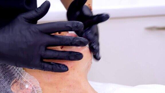 特写化妆师在黑色医疗手套应用化妆品霜女性脸部按摩运动在美容诊所或美容院进行皮肤护理