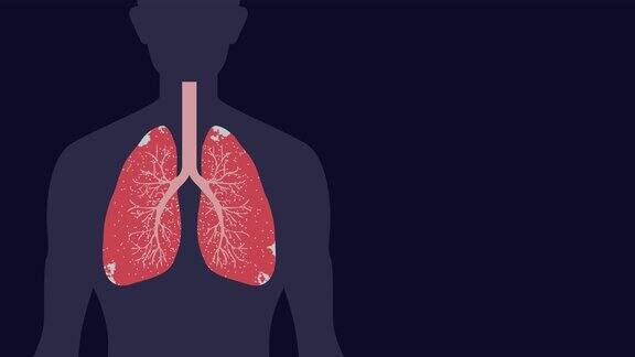 病毒或癌症在有拷贝空间的肺部发作