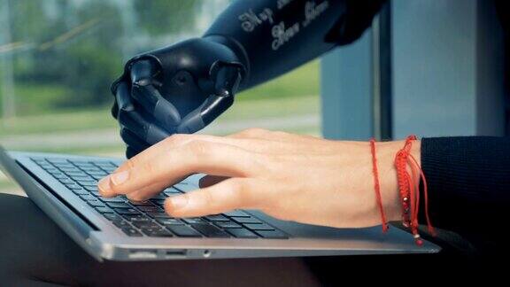 人类戴着一只仿生手用笔记本电脑工作Cyborg