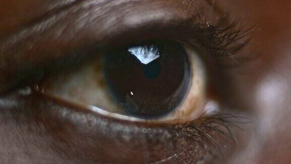 ECU一个非裔美国人的棕色眼睛