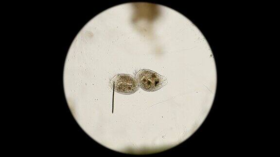 两只纤毛虫显微镜下观察