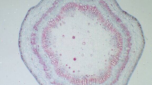 棉秆在显微镜下与移动的细菌、微生物和细菌受感染的观点植物细胞显微图用于植物教育瞄准镜下的棉花一种植物的茎