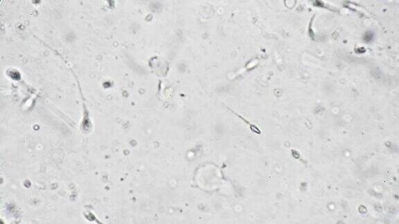 一个中年男子的精液在显微镜下放大1000倍