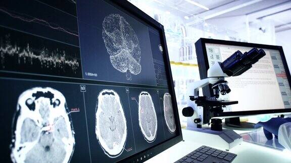 未来的实验室设备电脑屏幕上的脑电波扫描研究