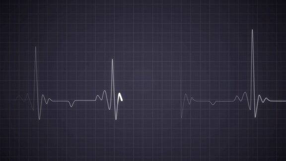 脉搏心脏骤停监测记录的心电图心跳心脏的节奏