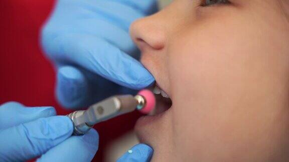 儿童牙科医生在牙科近距离专业清洁牙齿4k的视频牙科专业儿童牙齿卫生儿科牙医在牙科检查儿童病人