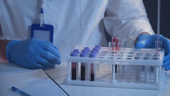 病理学家在实验室研究血液样本科学家在实验室处理DNA样本医疗保健血液检查血液研究实验室工作人员正在准备血液样本载玻片