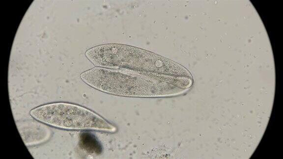 两种纤毛虫尾草履虫显微镜下观察