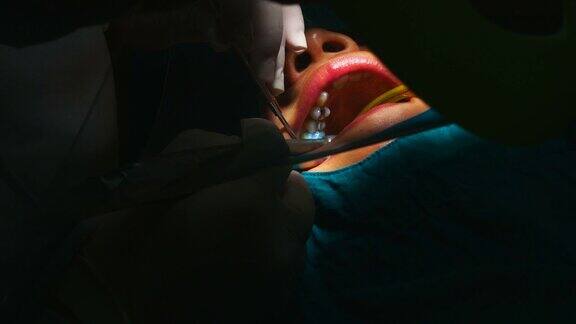 牙医为女牙医治疗牙齿