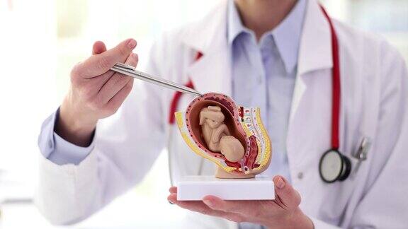 医生指着带胎儿的逼真的子宫模型
