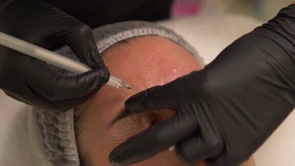 美容师用笔在病人额头上标出要注射肉毒杆菌的地方