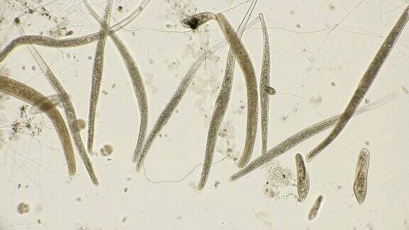 菌落螺旋口纤毛显微镜下观察