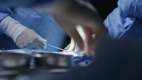 外科医生给病人做手术的手