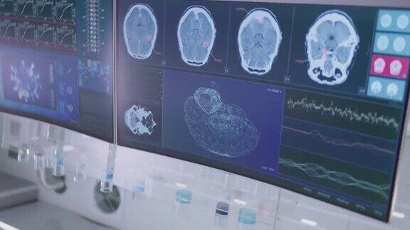 实验室设备、脑波扫描耳机、电脑屏幕上的脑电波研究垂直视频