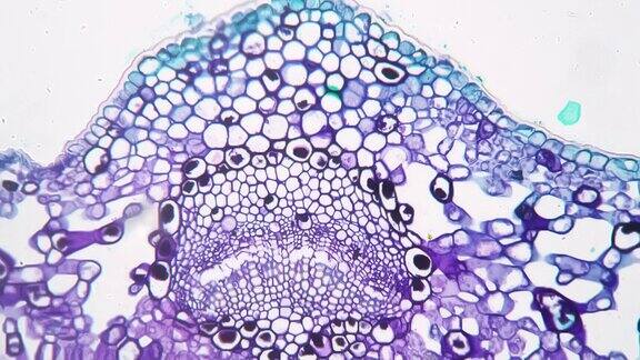 在200倍显微镜下对明亮的田野背景下的迎春花叶片