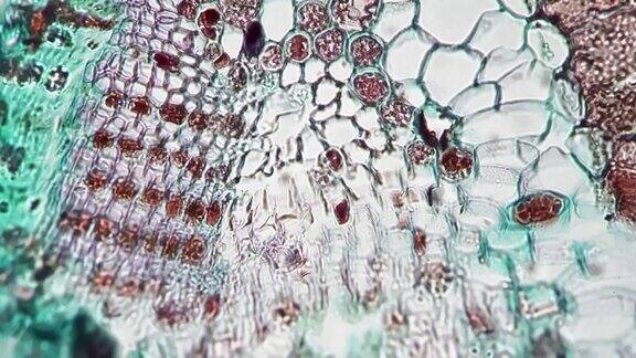 在400倍放大显微镜下对明亮视野下横切的松叶进行拍摄