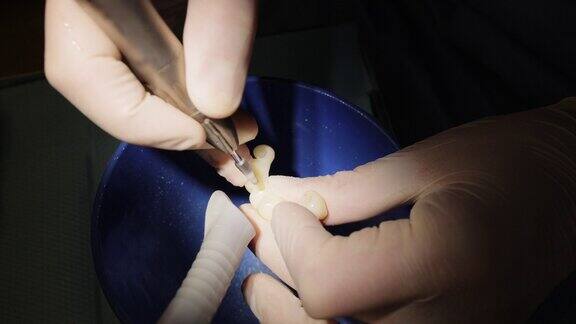 穿着防护服的牙科技师正在他的实验室里制作一颗假牙假牙的工作牙科技师使用假牙工作场所牙科技师