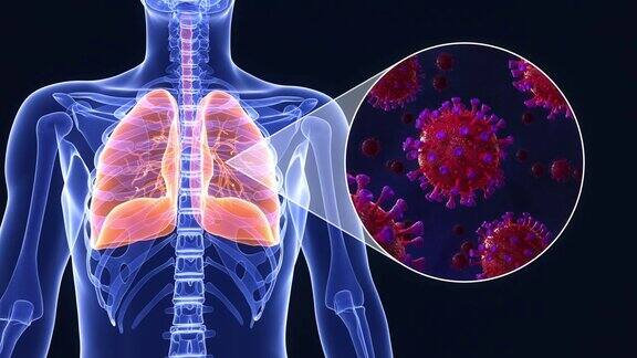 新型冠状病毒感染肺部三维动画