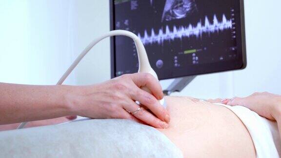 在医院里医生为孕妇做超声波超声波检查