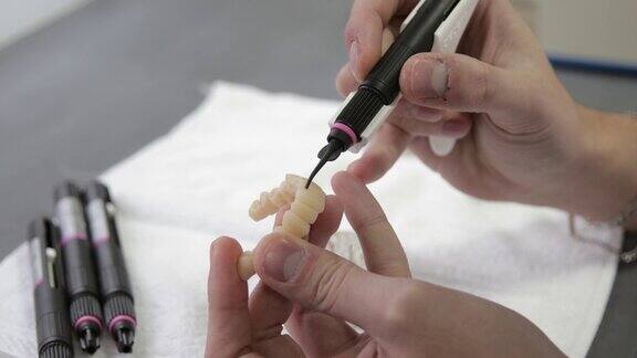 牙科技术员在3D模型上进行牙齿升级