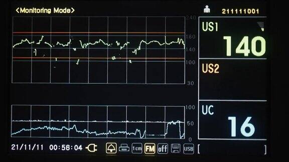 视频心血管内科ICU监护仪与住院患者生命体征