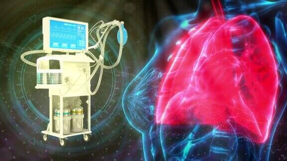 人类肺部和ICU冠状病毒呼吸机cg医疗3D动画
