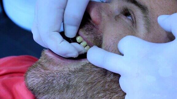 牙医-植牙