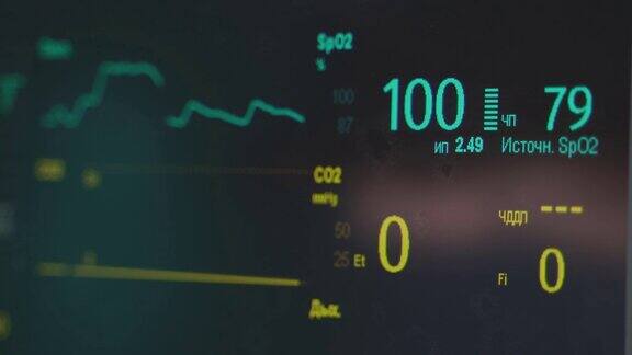 手术室的心电图监护仪手术室手术过程中监视器屏幕上显示的彩色心电图