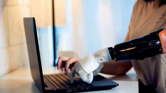 一位女士正用一只健康的机械手臂在她的笔记本电脑上打字