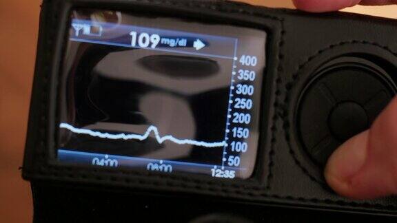 在dexcom接收器上检测血糖水平实时血糖读数