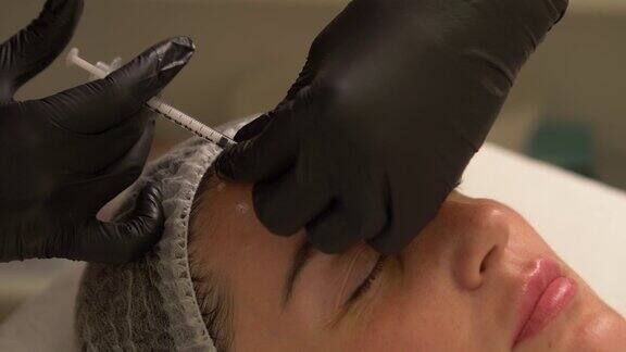 美容诊所美容师双手戴着手套在女性皮肤上注射衰老剂一位妇女接受美容美容手术肉毒杆菌素注射胶原蛋白4k拍摄