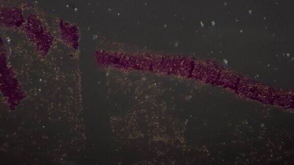 交叉光显微镜下放大200倍三种细菌的实验室载玻片