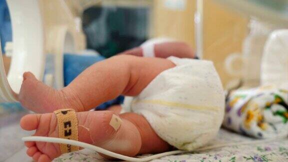 产科诊所拯救生命在医生监护下的保育箱中的早产儿特写婴儿婴儿的脚移动与医疗设备4k