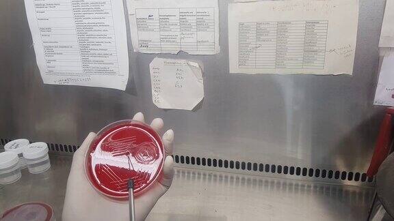 用接种环在血琼脂培养板上接种样品
