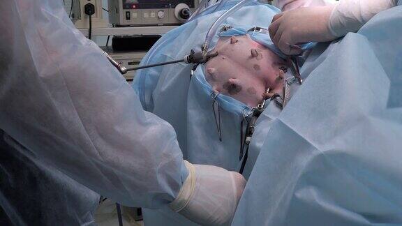 在外科手术中被麻醉的宠物侧躺着而兽医进行内窥镜腹部手术内窥镜手术中的宠物躺在手术台上