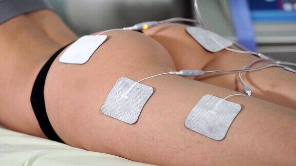 女人正在接受臀部电刺激疗法