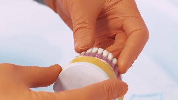 假牙牙根部牙科医生为病人做假牙的录像