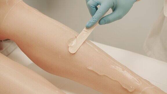 在激光脱毛前医生用手在女士腿上涂上特殊的凝胶