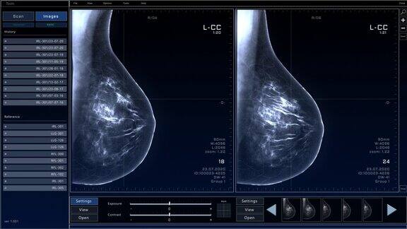具有多窗口和数据的乳腺扫描模型计算机显示器和笔记本电脑屏幕x射线扫描结果的医学研究环境软件