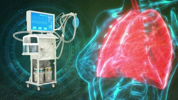 cg医学3D动画肺和ICU肺呼吸机